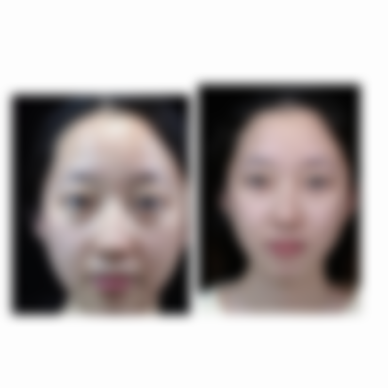 金涥泽医生顾客实例图片:实力见证美丽蜕变