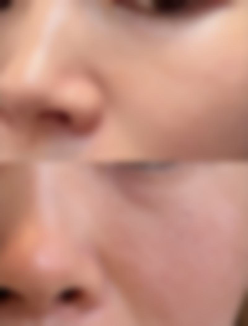 新疆张瑞红医疗美容诊所可靠吗