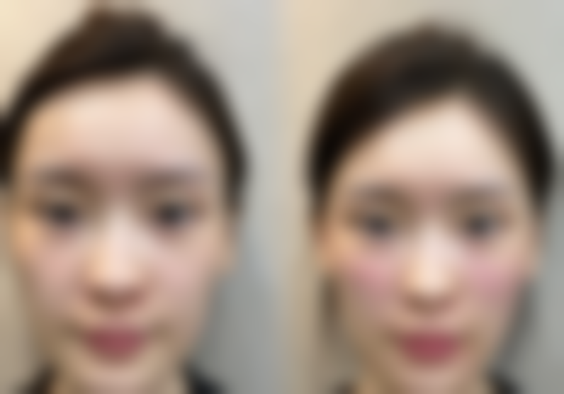 厦门兰的整形医院口碑好不好?附真实患者口碑评价