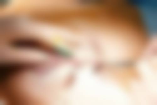 怎样去除脸部被烫疤痕：精细处理守护面部容貌