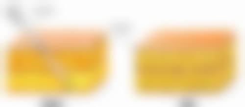 国内医学科学 院整形外科医院解读哺乳后半年隆胸可行性