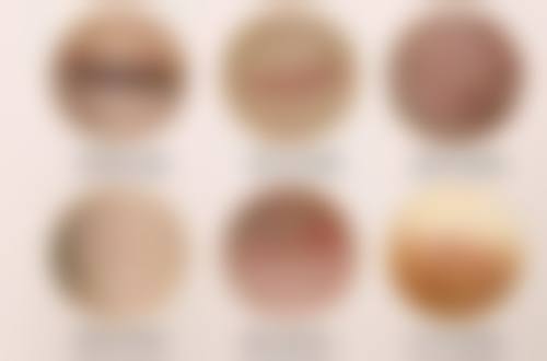 南京鼓楼医院疤痕疙瘩激光治疗副作用探讨