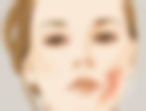 尾段:疤痕护理,贵在坚持