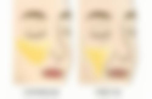 去除疤痕疙瘩的日常护理：祛疤路上的后勤保护