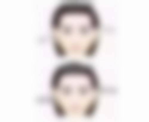 医院把控注射剂量：一次注射多少合适