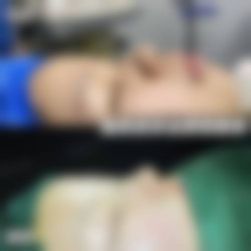 广州肌光医疗美容诊所怎么样，价格表