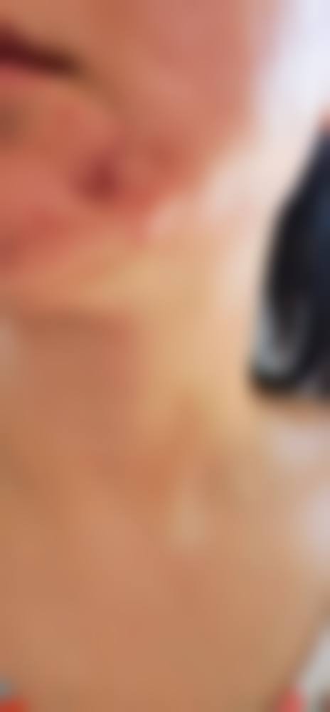 江西吉安馨颜整形怎么样，口碑好不好？