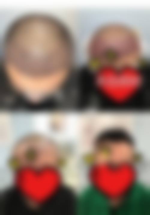 四、汨罗圣美医疗美容诊所怎么样，更擅长什么