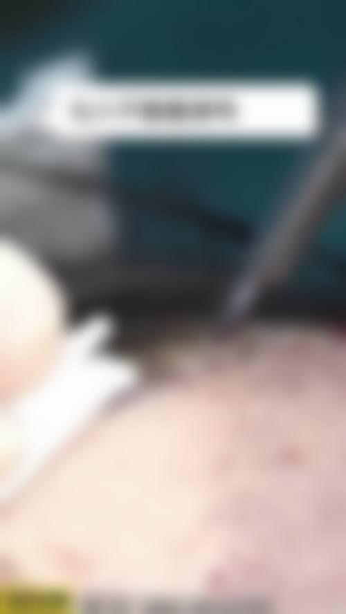 张海明医生简介之做手术价格