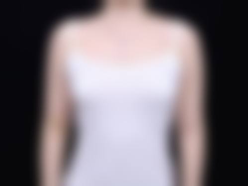 七、西安艾娜薇特整形医院口碑好不好?附真实患者口碑评价