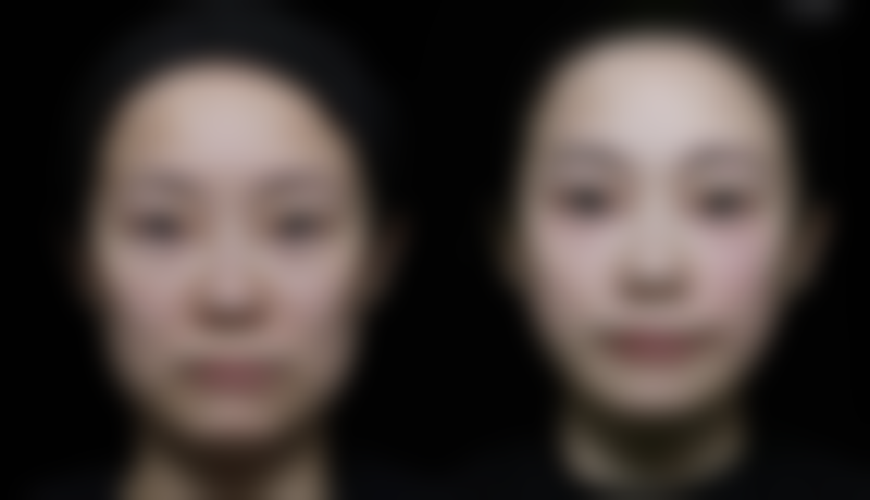 张吉医生简介做手术价格