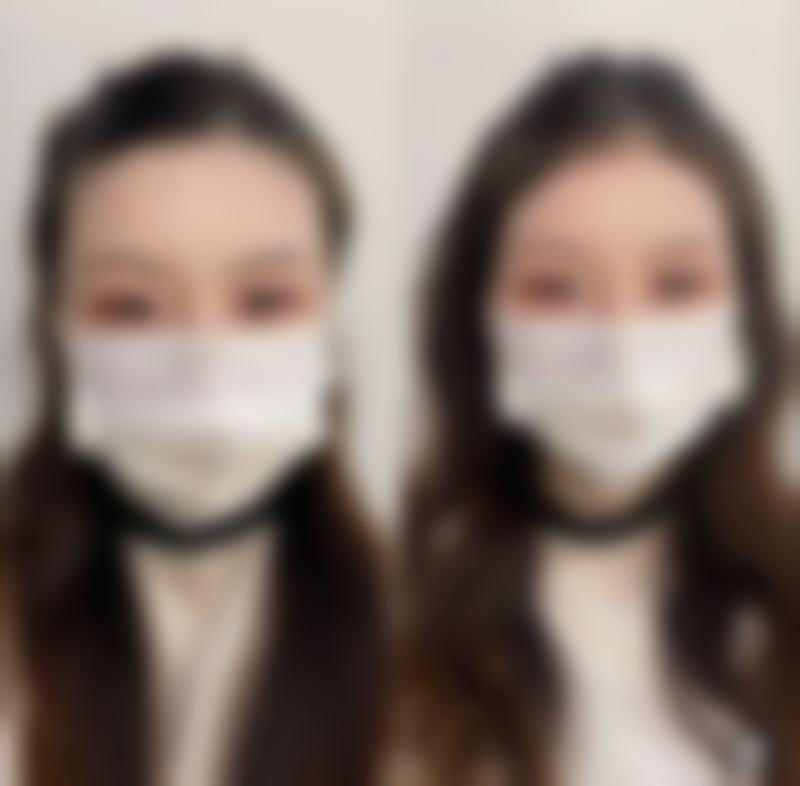 医院指导护理：剂量与修复的关系