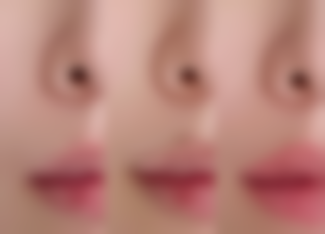 怎样清除擦伤疤痕，3招淡化脸部+手部疤痕，激光+按摩双管齐下