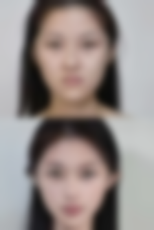 开启专属祛疤之旅