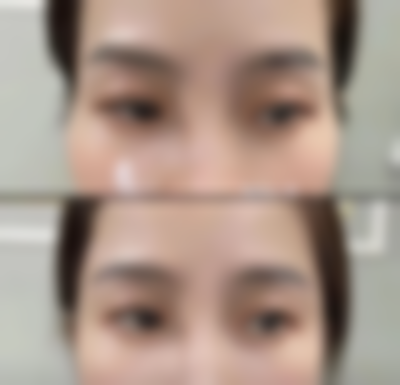 韩国爱妮inee皮肤科医院价格表