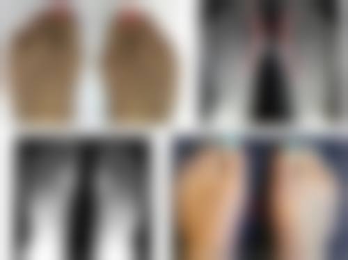 李吕力医生项目优势