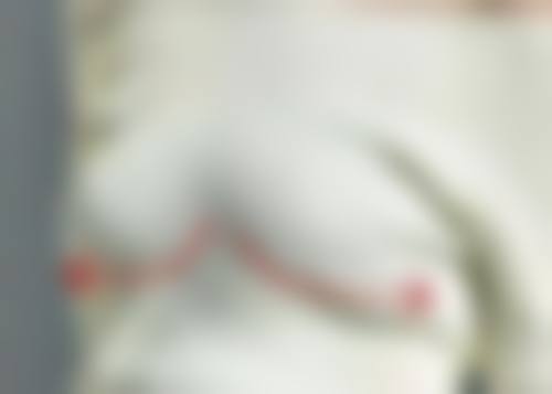 双眼皮怎么去除肉条感——2026年全新优质修复医院推荐