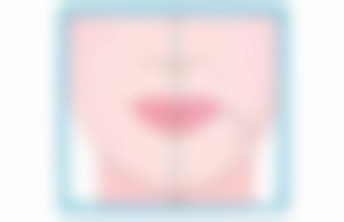 双眼皮埋线效果如何？北京上海专家亲测自然无痕，恢复快适合年轻人