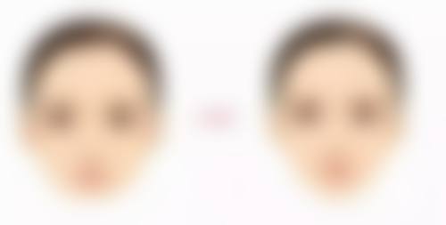 怎么可以臀部抽脂？公立医院安全无痛塑形，快速提臀不反弹