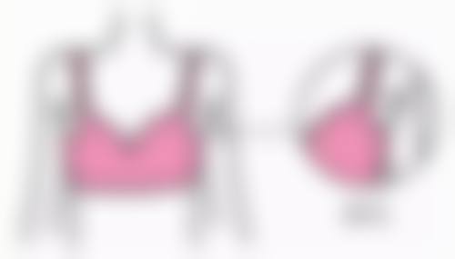 双眼皮怎么去除肉条感——修复黄金期的奥秘