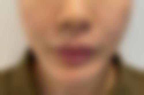 深圳广美整形医疗美容门诊部怎么样,价格表情况