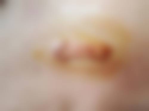 广州唯人昱美医疗美容诊所更擅长什么手术