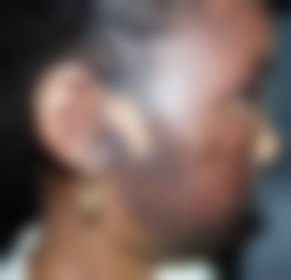 深圳柏伊美妍整形医院怎么样，口碑评价如何？