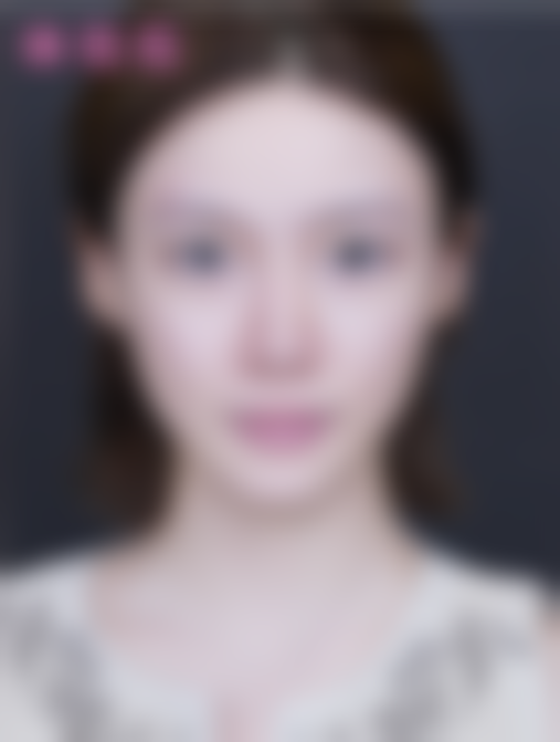 北京米兰柏羽丽都医疗美容医院牟严儒做的手术怎么样？5A级医院+吸脂移植专家，数万案例塑美效果惊艳！