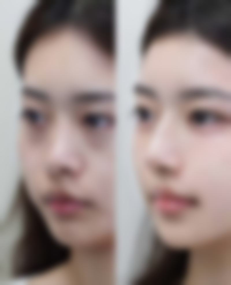 韩国AB整形外科的抖音团购活动有哪些，价格表如何？