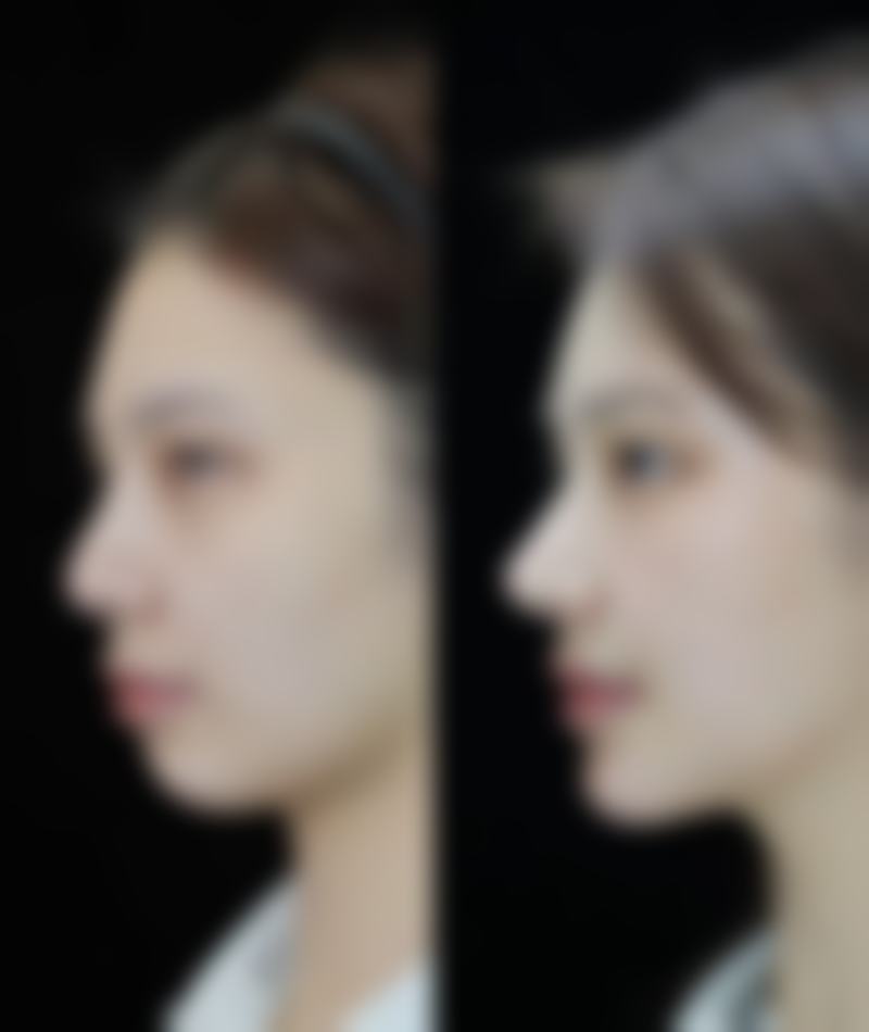 怎样祛除眼袋泪沟之按摩手法：日常护理的关键法宝