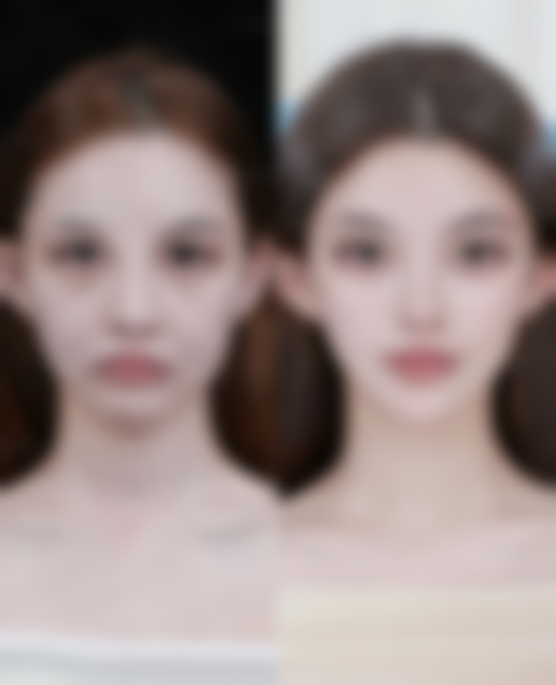 告别熊猫眼，重拾明亮双眸的自信