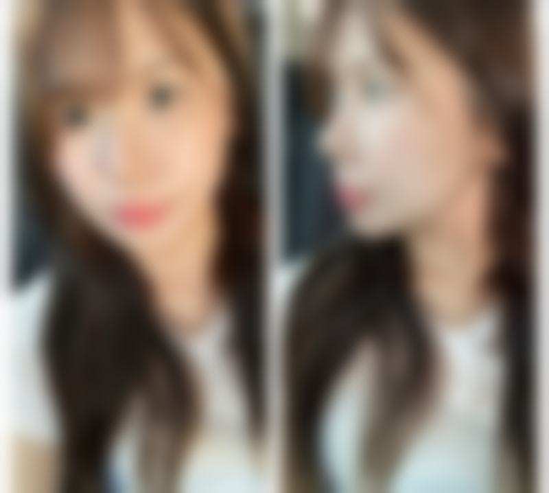 上海美蒂菲医疗美容门诊部怎么样，更擅长什么