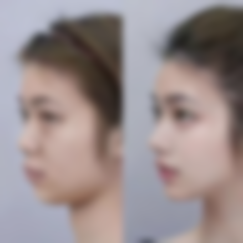 汤炳南医生简介口碑如何