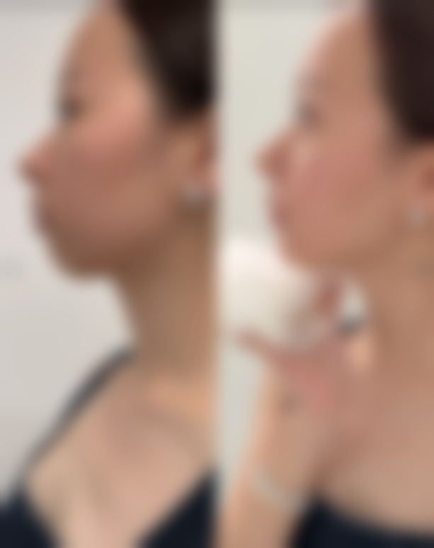 深圳柏伊美妍整形医院怎么样地址及乘车路线