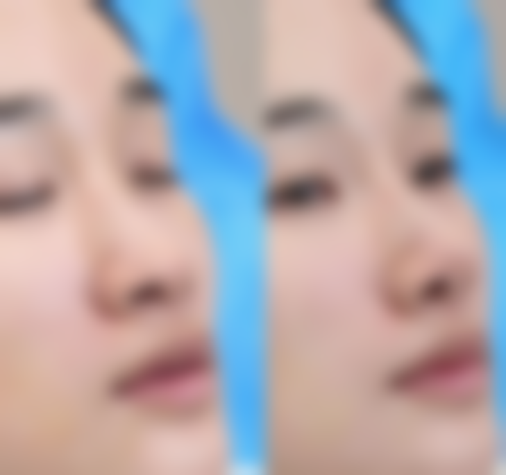 深圳广美整形医疗美容门诊部怎么样,地址在哪里