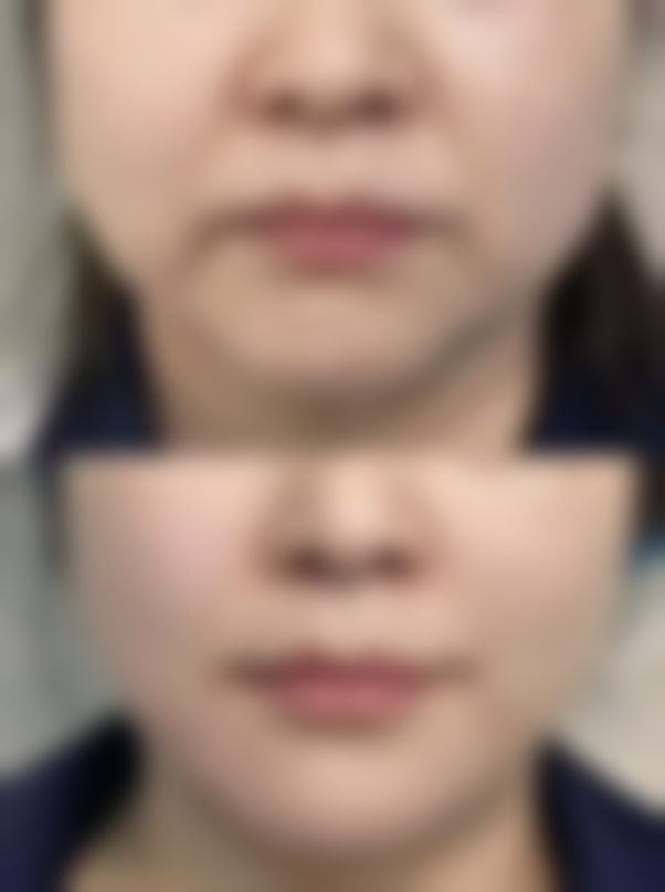 南京哪个隆鼻比较好？公立三甲VS私立名院，医生+设备+口碑全解析！