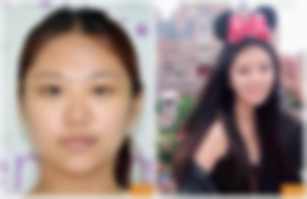 北京禾美嘉医疗美容门诊部刘娟娟技术水平可靠吗——价格与实例参考