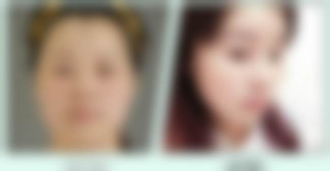 北京禾美嘉医疗美容门诊部任学会技术特点——北京润美玉之光医疗美容门诊部