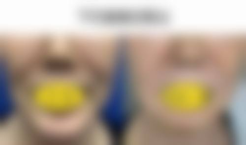 七、郑州华领整形医院口碑：真实患者的不同评价