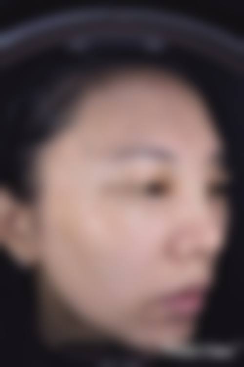 山东临沂人民医院医学整形美容科地址及乘车路线