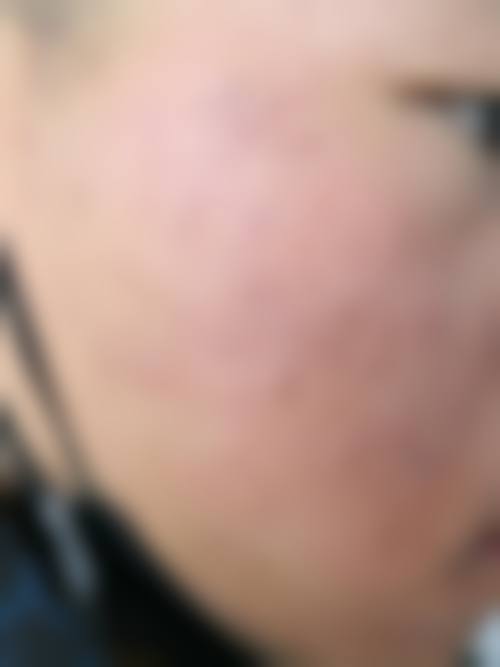 南通英莎医疗美容门诊部李辉4980元特别优惠活动:机会难得手慢无