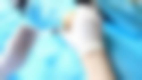 杭州悦可医疗美容诊所熊员平实例成效——杭州薇琳医疗美容医院