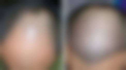 湘南美容水户院抖音团购活动及价格表