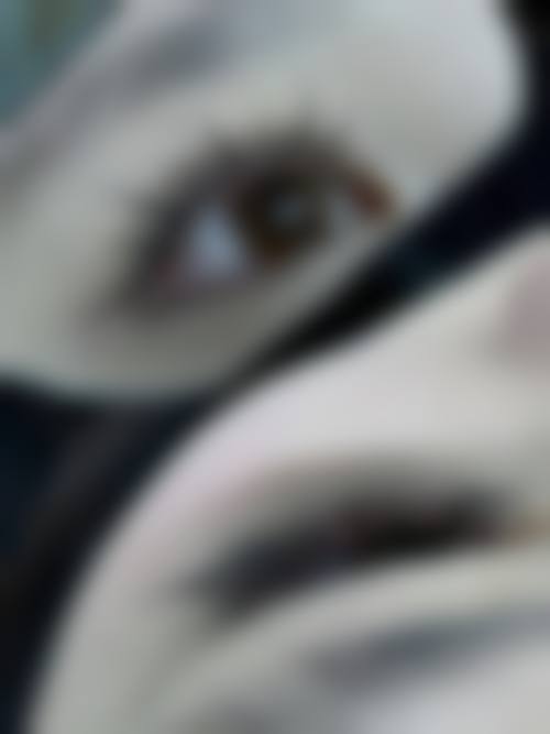 杭州悦可医疗美容诊所熊员平实例成效——杭州美莱医疗美容医院