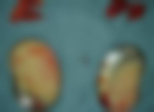 昊婷医生简介做手术价格