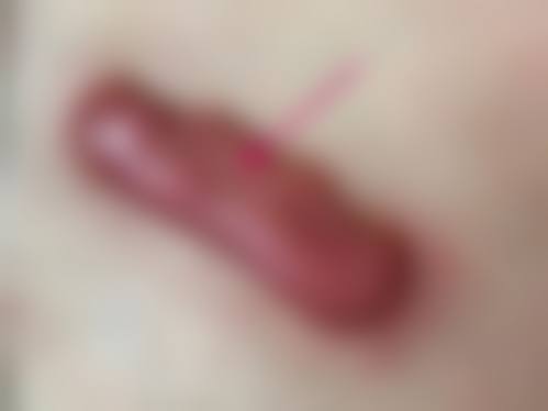 南通英莎医疗美容门诊部李辉其他项目预约:多样选择总有适合你