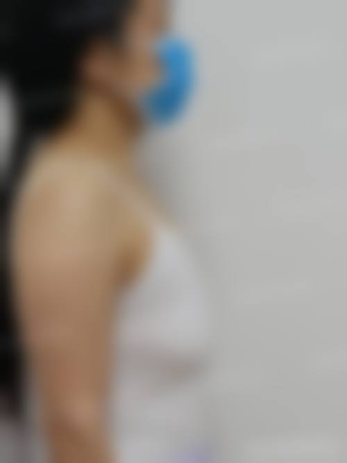 山东临沂人民医院医学整形美容科口碑好不好?附真实患者口碑评价