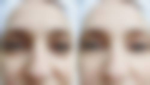 青岛市市立医院（烧伤整形科）价格表