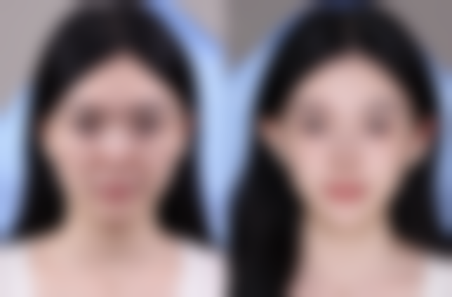 为什么要选择南通英莎医疗美容门诊部李辉医生