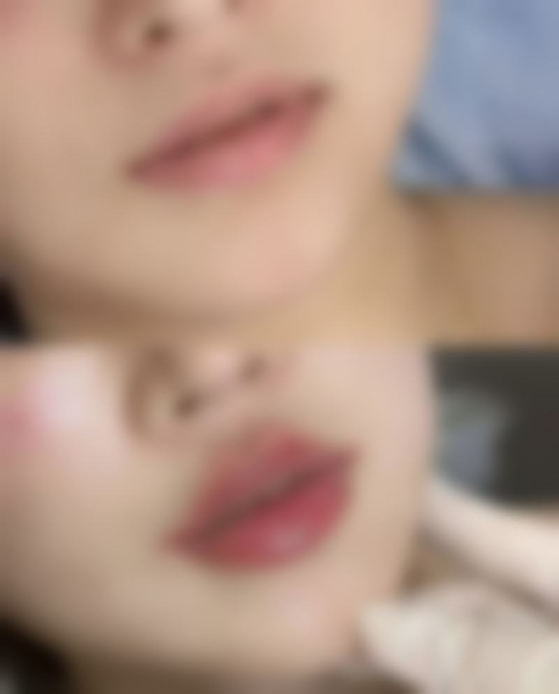 疤痕体质的人纹眉成功几率评估及提升秘诀